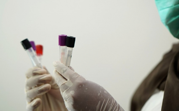 В тюменском вузе займутся тестированием вакцины от COVID-19